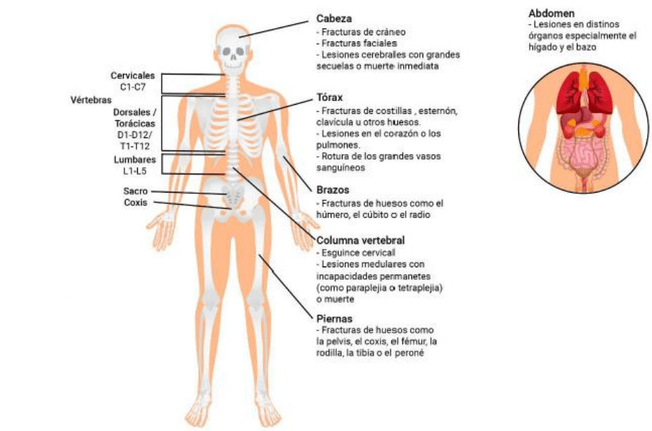 Lesiones mas comunes en los accidentes